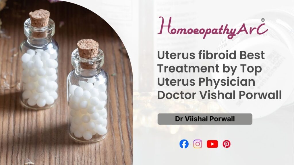 Uterus fibroid Best Treatment by Top Uterus Physician Doctor Vishal Porwall